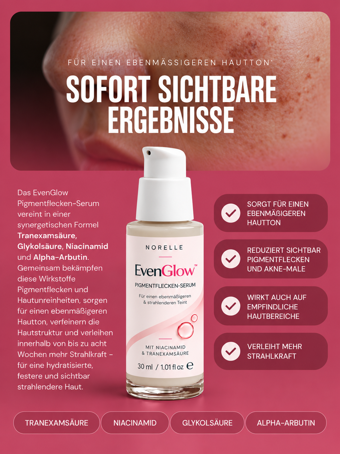 Norelle EvenGlow™ - Pigmentflecken - Serum